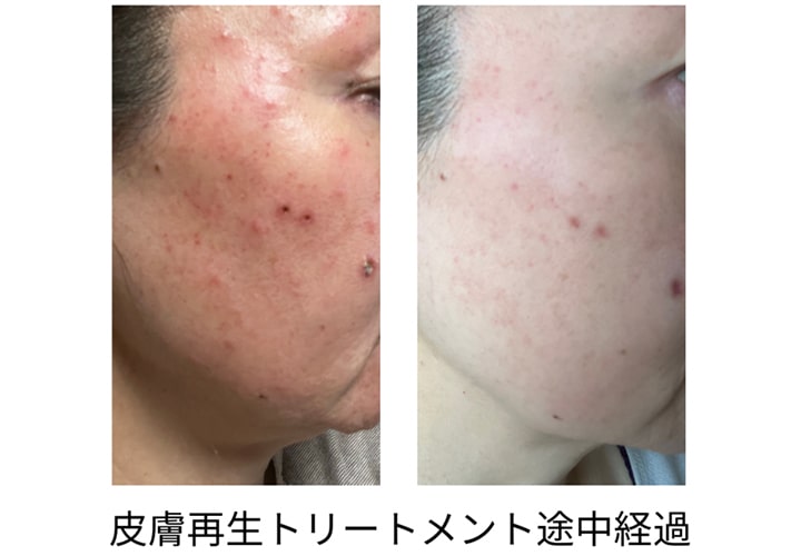 ビフォー & アフター