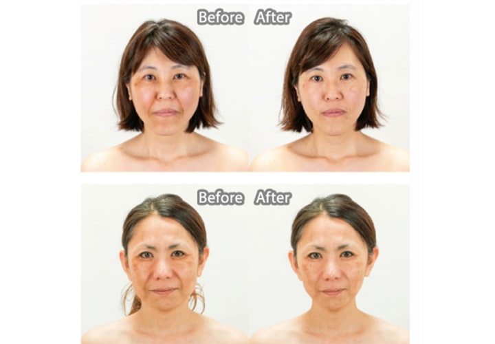 ビフォー & アフター